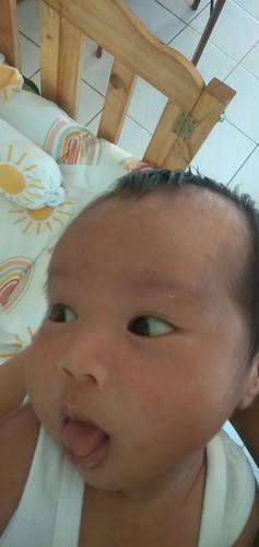 mga Mi anu maganda cream para mawala yung rashes sa muka ni baby 23days napo sya yung effective po