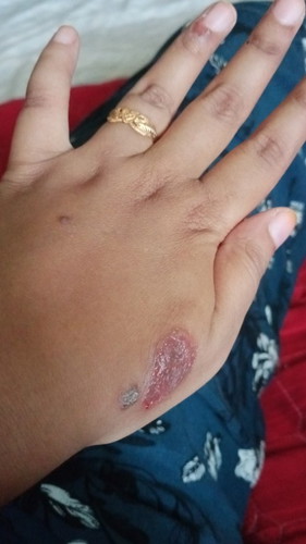 alahan pregnant😔 minta doakan sy diberi kesembuhan