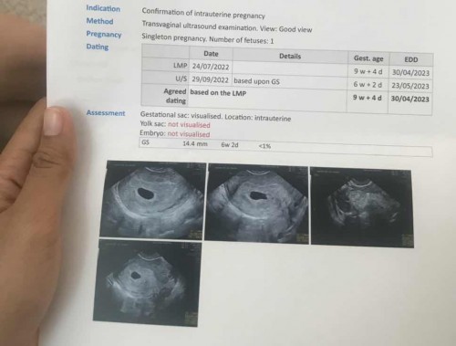 9สัปดาห์แล้วยังไม่เจอตัวเลยค่ะปกติมั้ยคะ