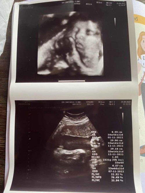 สอบถามน่อยค่า