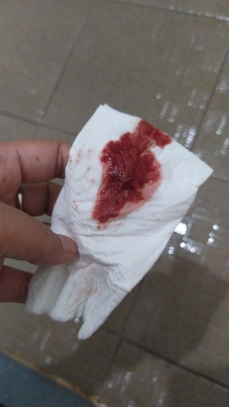 Darah impalntasi atau bukan?