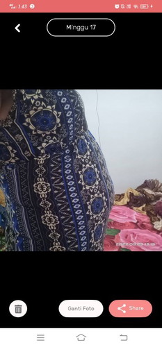 Wajar ga ya,udah 17 weeks mau jalan 18 weeks yang gede perut bawahnya aja