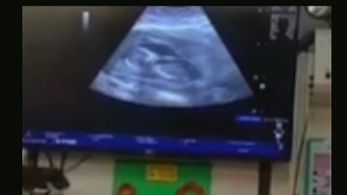 ลูกคนที่2 อยากรู้เพศไวๆจังเลย
