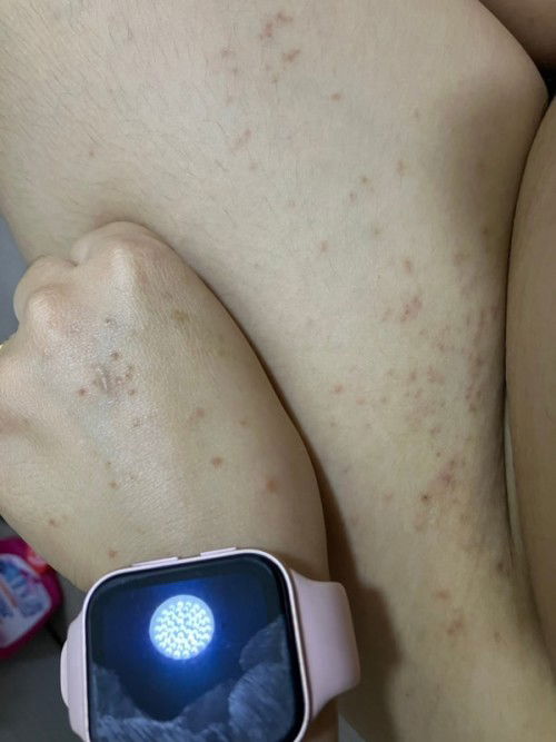 สอบถามแม่ๆหน่อยค่ะ