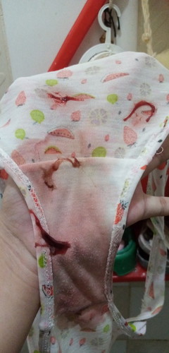 Mucus plug ba to mga mi?