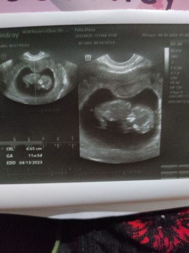 Okay lang po kaya na nakadapa si baby? At magbabago pa kaya posisyon nya? Salamat po.