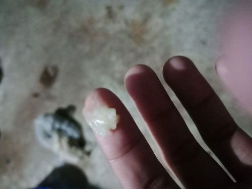 มูกใสๆออกจากช่องคลอด