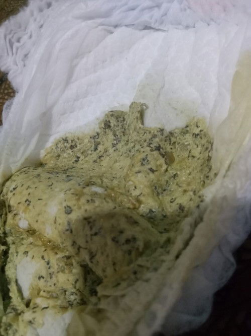 Maaf bunda" saya mau tanya anak saya usia 5bln di kasih makan pisang kenpa Eek nya seperti ini