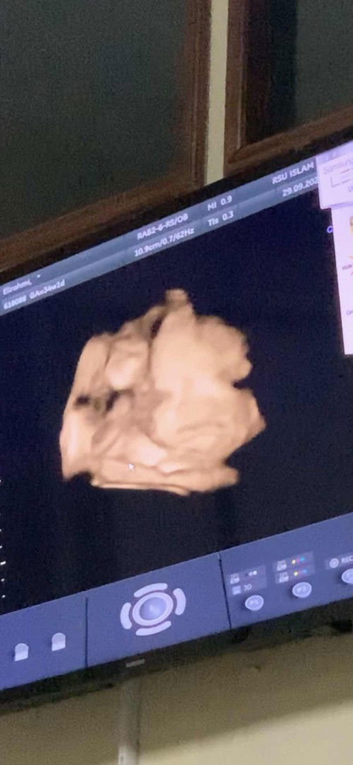 Check Up 34 Weeks 👶