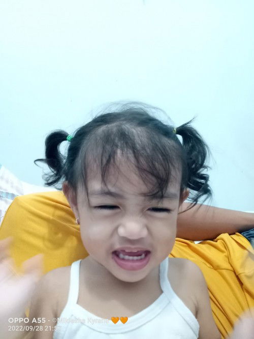 white spot sa pisngi