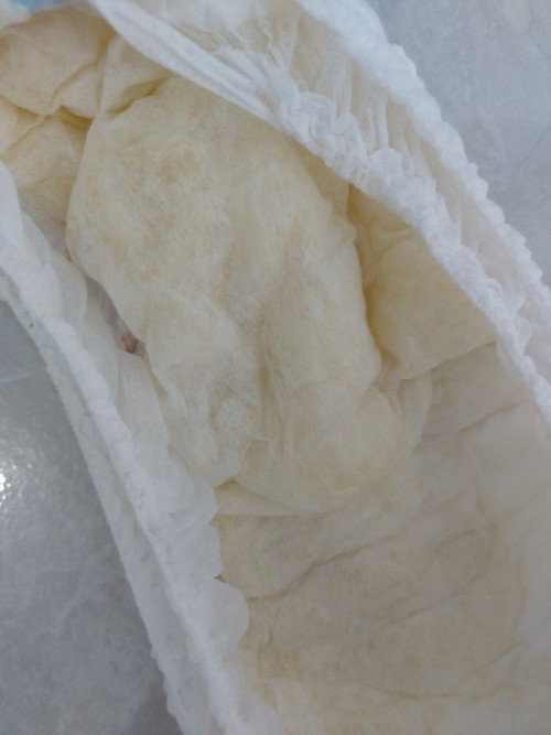 Bayi kencing pagi hari bau menyengat warna pekat