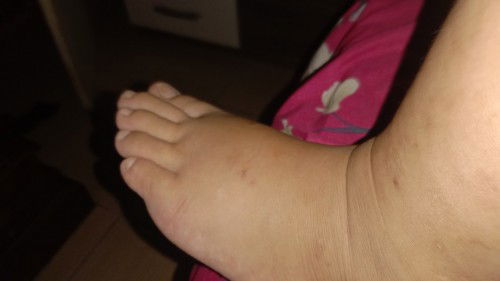 Usia kehamilan 37minggu