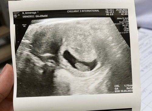 ฝากครรภ์ 9 สัปดาห์