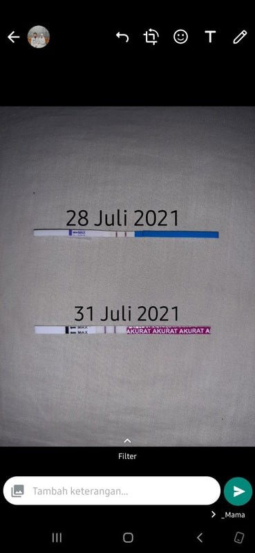 Sakit demam tinggi, hidung tersumbat  pas telat 3 hari menstruasi