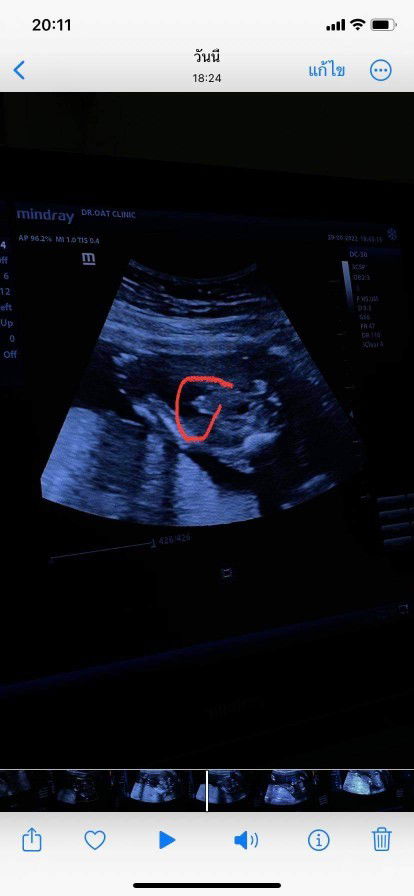 สอบถามหน่อยค่าาาา