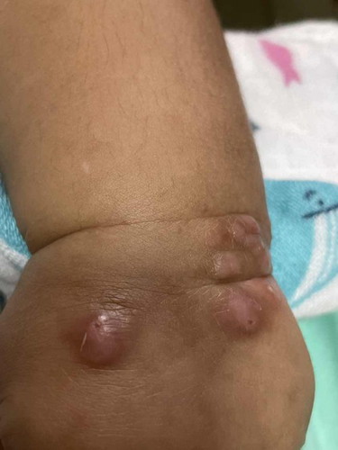 What are these bumps or blisters on my 13wo :(