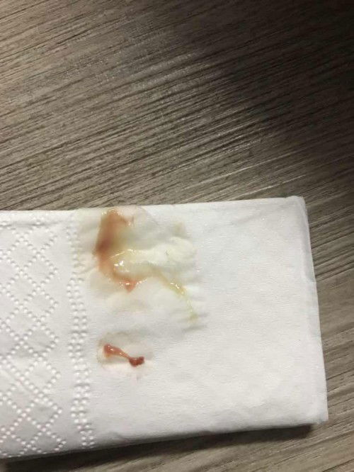 15 minggu keluar lendir keputihan darah