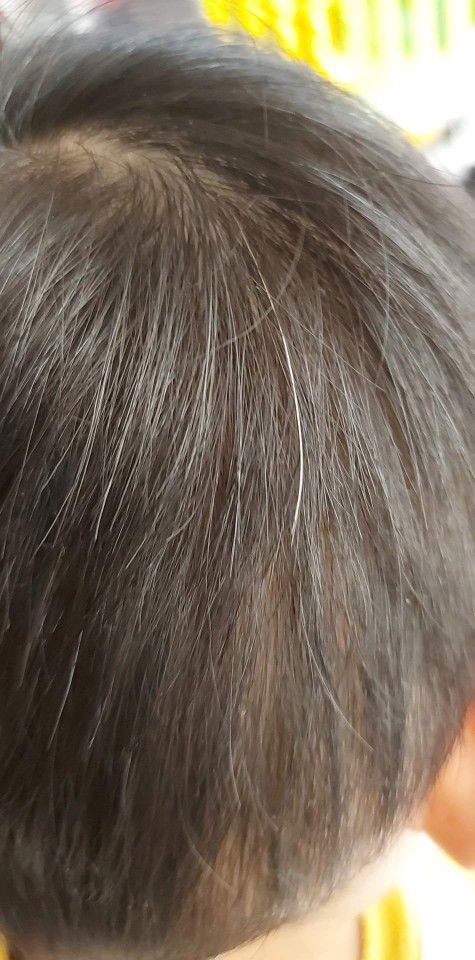 May gray hair si baby?