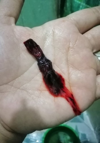 Is this a fetus?