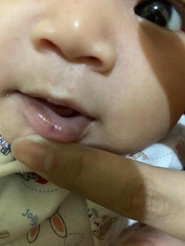 Ada yang sama gak ya warna bibir bawahnya kayak gtu , penyebabnya apa ya๐ฅบ๐ฅน