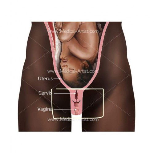 Sakit ngilu kat dlm vagina