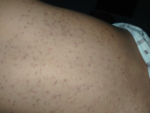 ขอสอบถามหน่อยคะ