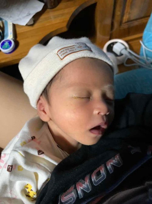 น้องเกิดใหม่ มีขี้ตาแฉะค่ะ