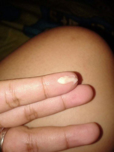 yeast infection?