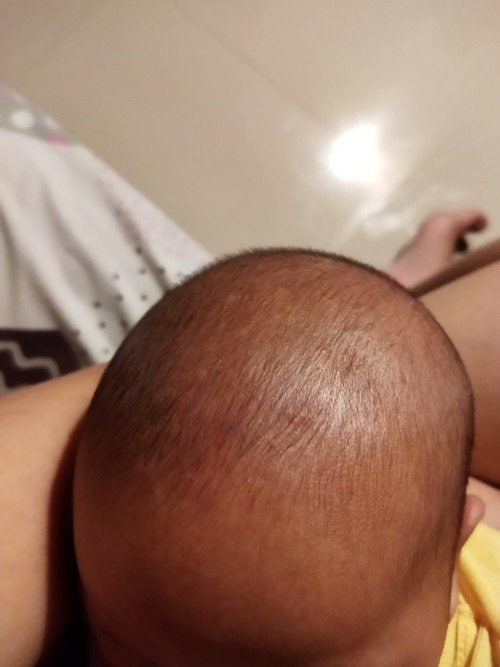 Kerak di kepala bayi