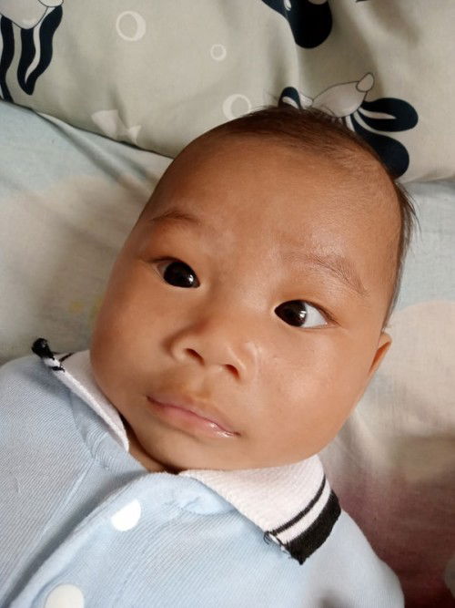 Kenapa yaa bayi 3 bulan wajahnya hitam dan juga ada putih*gitu di wajahnya.. Kaki tnganya putih