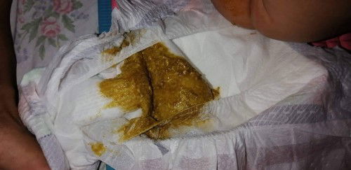 Brown Poop Mixfeeding