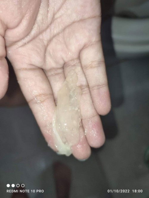 มีมูกใสออก