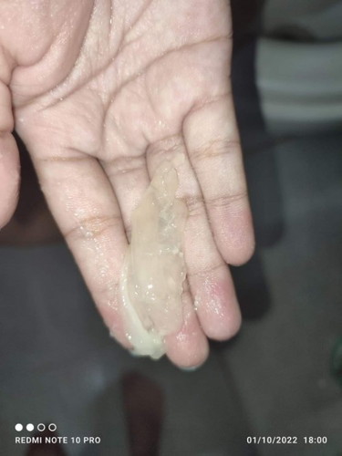 มีมูกใสออก