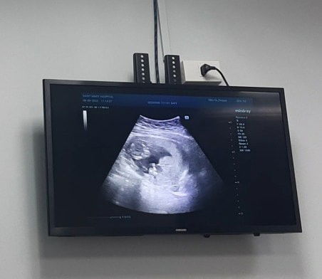 ผู้ชายหรือผู้หญิงค่ะ แม่ๆดูออกไหมคะ