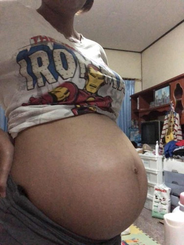 28 week ปวดขาข้างเดียว