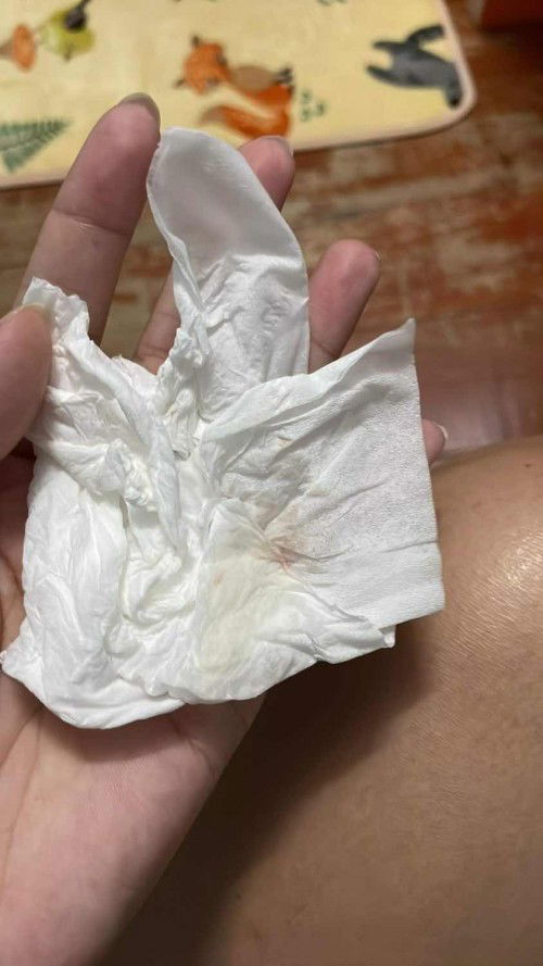 แม่ๆบ้านไหนเคยเป็นบ้างคะมีเลือดซิบๆออกนิดนึง30+1