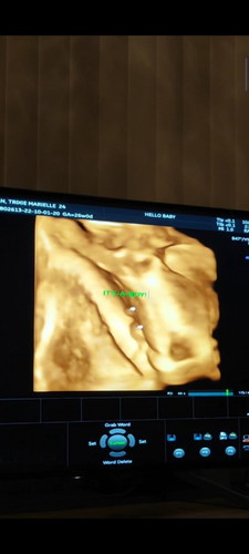 Baby position