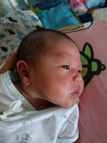 ลูกบ้านไหนแพ้โปรตีนผ่านนมแม่บ้างคะ(โปรตีนโบต้าพี)
