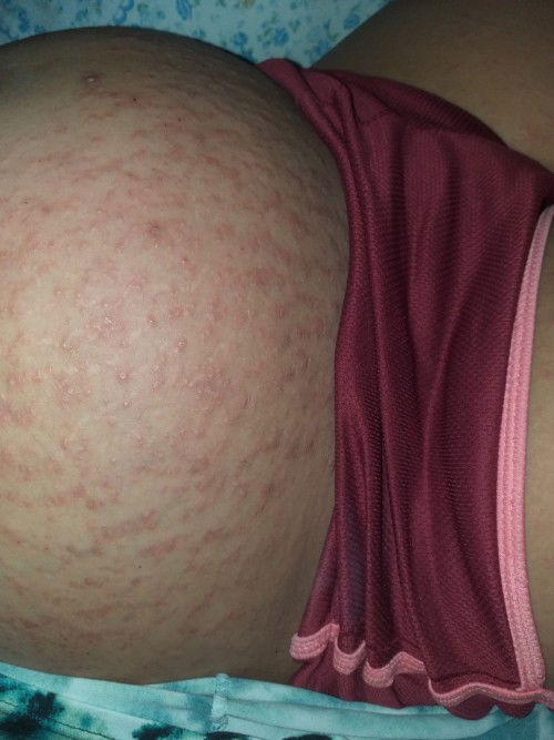 Kabuwanan ko na po at ganito nangyari sa tyan ko.