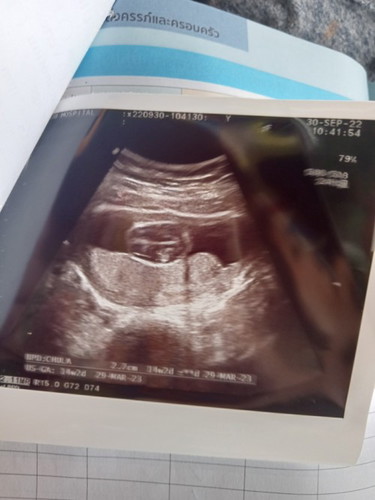 รบกวนช่วยดูให้หน่อยค่ะ