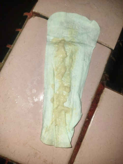 Keputihan UK 22 week