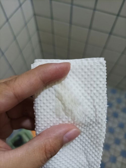 Tanong lang po about po sa discharge