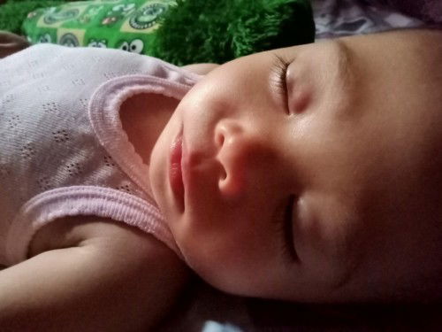 Benjolan di kelopak mata sebelah kanan anak