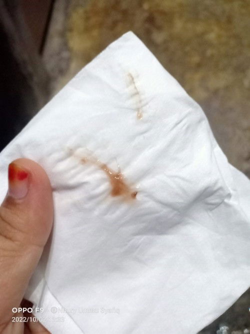 Ada yg pernah ngeflek seperti inikah bund??
Usia kandungan 6 week tadi pagi udah ke bidan