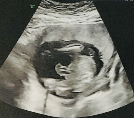 แม่ๆๆช่วยดูทีคะ แบบนี้ชายหรือหญิงคะ