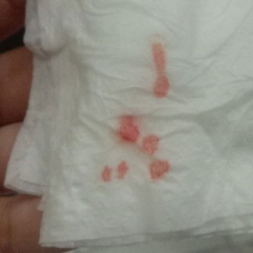 Bun saya hamil 11 minggu 2 hari trus ngplek sedikit,saran ny bun hamil pertama