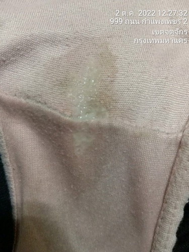 ตกขาวคืออะไร