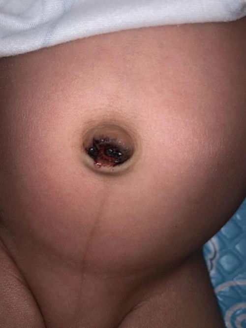 สอบถามแม่ๆค่ะ กังวลมากเลย