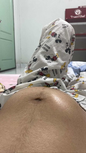 ตั้งครรภ์ ท้องแรก