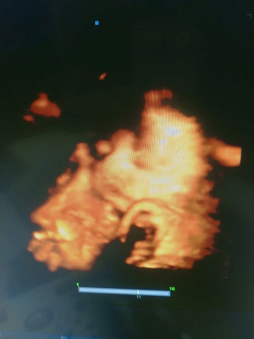 รบกวนขอคำปรึกษาค่ะ